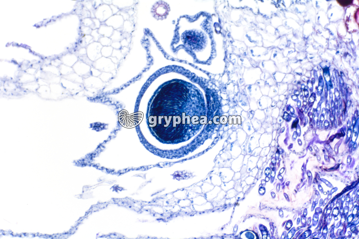 Hépatique (Marchantia) - embryon dans la capsule formant le sporophyte x25 - gryphea.com